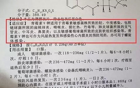 美国女子滥用抗生素，舌头长出大量黑毛！滥用抗生素下场太可怕（组图） - 15