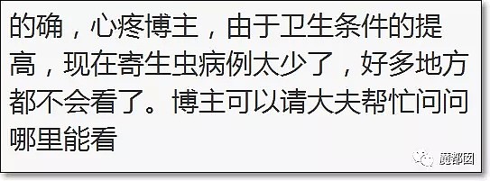 惊呆！一男子从屁股里摸出白色长条粘液虫！医生都束手无策…（组图） - 23