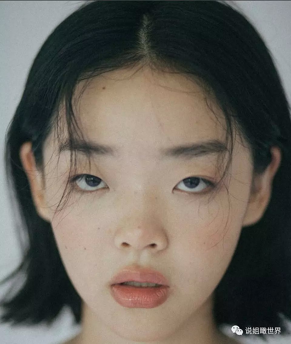 18岁的她，脸上全是亚洲人最嫌弃的缺陷，却成为LV、Gucci争夺的宠儿（组图） - 7