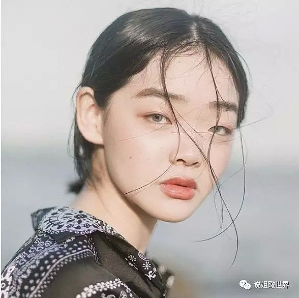 18岁的她，脸上全是亚洲人最嫌弃的缺陷，却成为LV、Gucci争夺的宠儿（组图） - 20