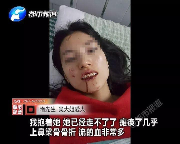 如此待客：游客撞断鼻骨 景区不先救人反要证据（组图） - 1