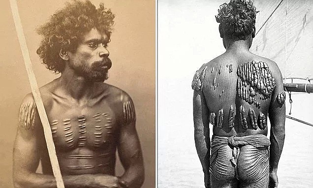 澳洲土著全身布满伤痕，居然是部落传统！没疤的人还会被嘲笑？（组图） - 3