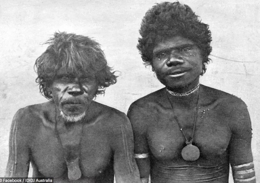 澳洲土著全身布满伤痕，居然是部落传统！没疤的人还会被嘲笑？（组图） - 4