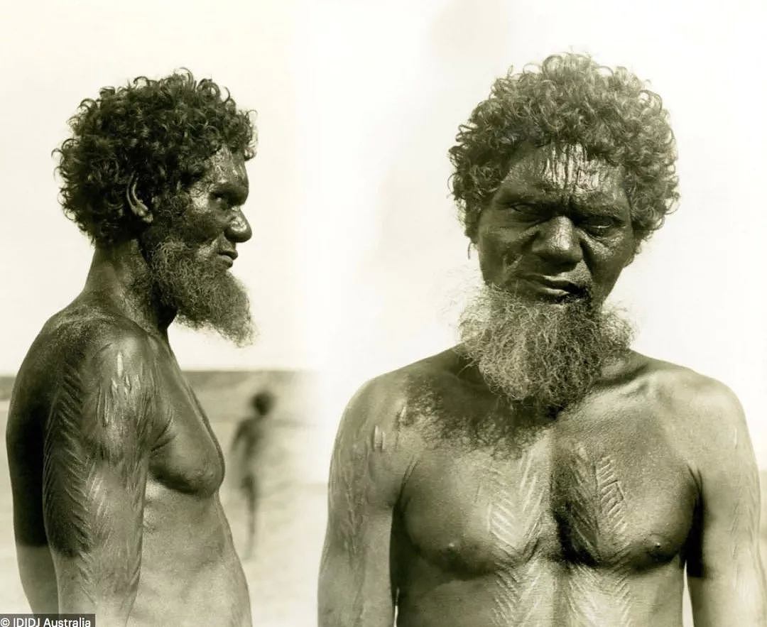 澳洲土著全身布满伤痕，居然是部落传统！没疤的人还会被嘲笑？（组图） - 12