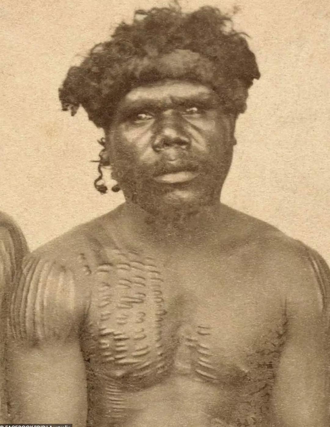 澳洲土著全身布满伤痕，居然是部落传统！没疤的人还会被嘲笑？（组图） - 13