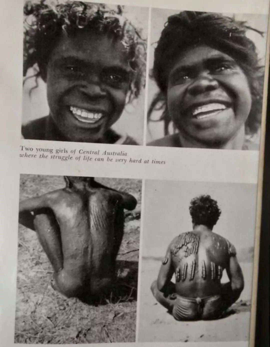 澳洲土著全身布满伤痕，居然是部落传统！没疤的人还会被嘲笑？（组图） - 17