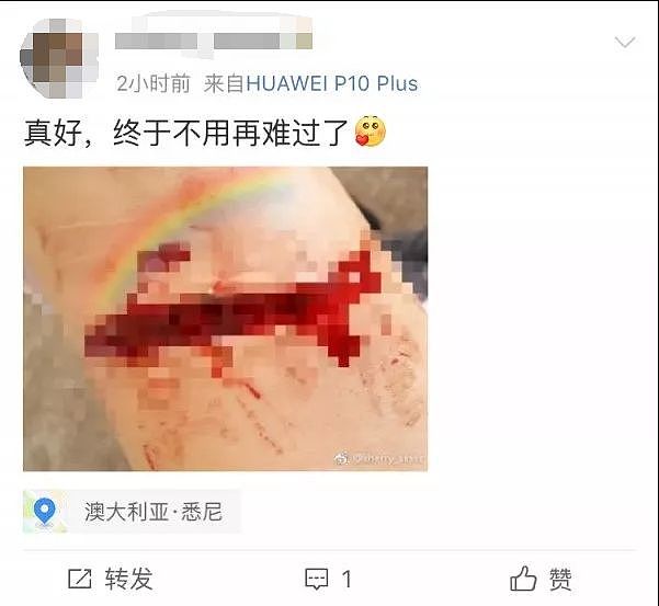 中国留学生跃轨自杀！当场死亡，年仅18岁！悉尼华女直播割腕，海外的我们，谁来关心？（组图） - 5