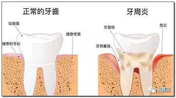 吐血！国产瑰宝级牙膏也造假？！能止血竟然靠的是添加西医处方止血药？（组图） - 28