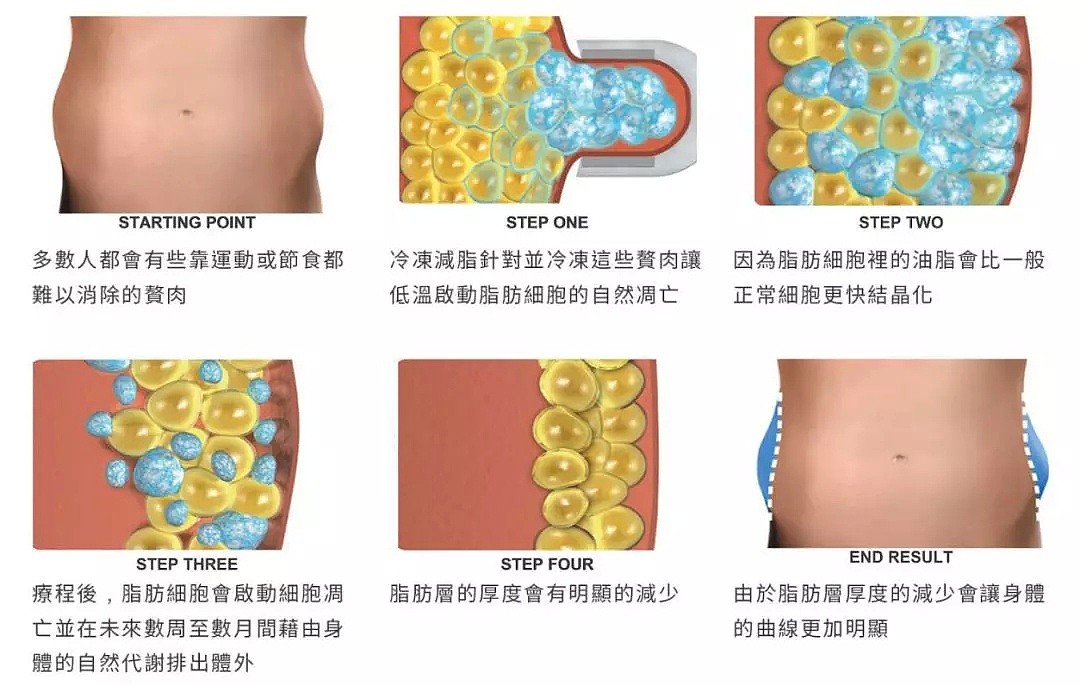 听说悉尼有了减肥黑科技，脂肪团们都瑟瑟发抖！ - 8