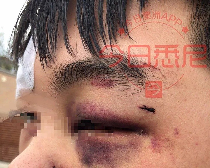 愤怒！中国女留学生巴士上遭4名澳洲青年性骚扰！同车中国男生挺身而出！网友：是个爷们！（组图） - 33