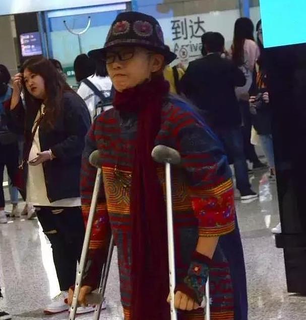 60岁杨丽萍现身机场，拄着拐杖走路吃力，几十万养的长指甲不见了