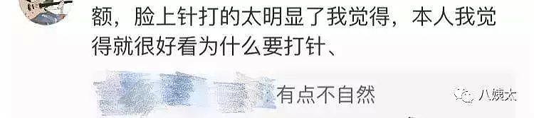 34岁戚薇脸又变了，磨皮严重撞脸毛晓彤，网友：针打多了（组图） - 10