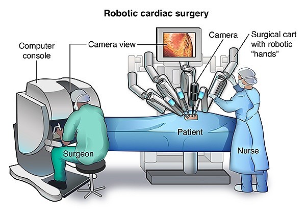 英国首例机器人心瓣手术：现场大乱 病人不治身亡（组图） - 2