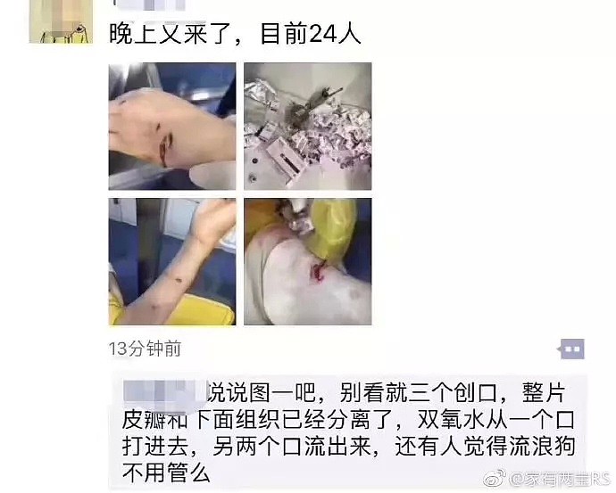 视频曝光！温州流浪狗咬伤73人，最小仅2岁…警方仍在搜捕（视频/组图） - 7