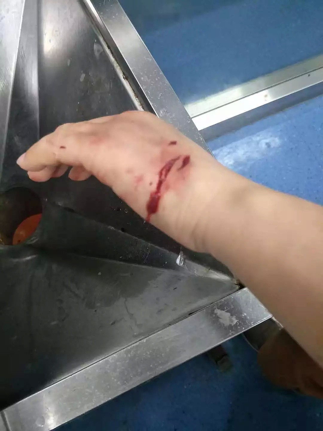 视频曝光！温州流浪狗咬伤73人，最小仅2岁…警方仍在搜捕（视频/组图） - 11
