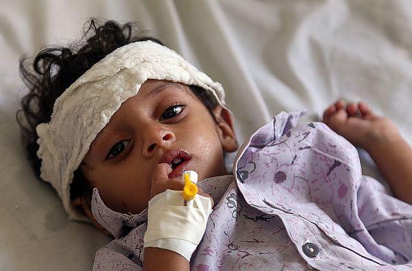 也门战争打了4年8.5万儿童饿死:连哭都没力气！
