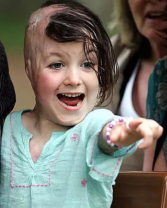 6岁前经历两次车祸的澳洲天使，一路艰辛牵动2400多万澳人的心！她用勇气和微笑鼓舞人心，更成为澳洲希望的象征（组图） - 28