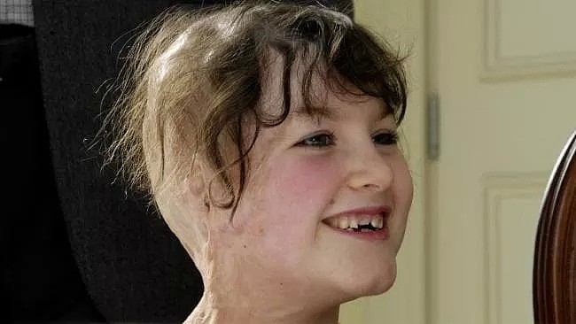 6岁前经历两次车祸的澳洲天使，一路艰辛牵动2400多万澳人的心！她用勇气和微笑鼓舞人心，更成为澳洲希望的象征（组图） - 39