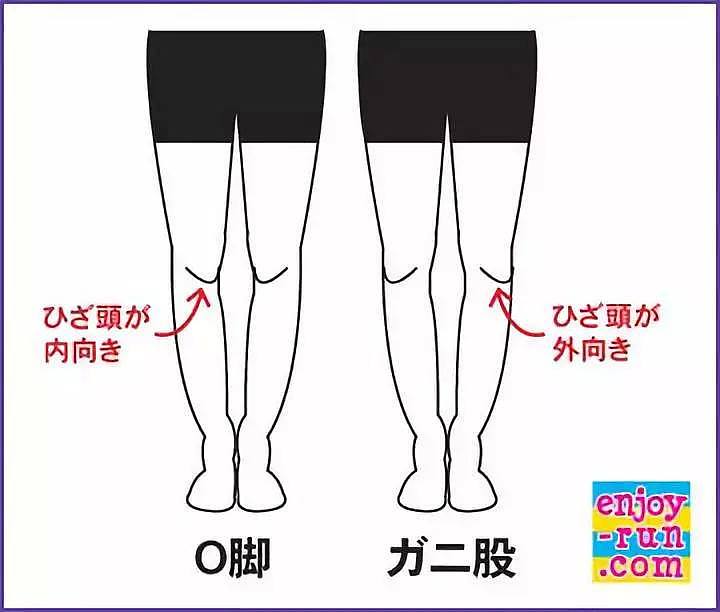 为何日本女生“罗圈腿”居多？揭开腿的秘密（组图） - 4