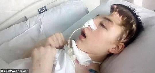 15岁男孩为救母亲与歹徒搏斗颅骨受重创 19个月后英雄少年还是走了
