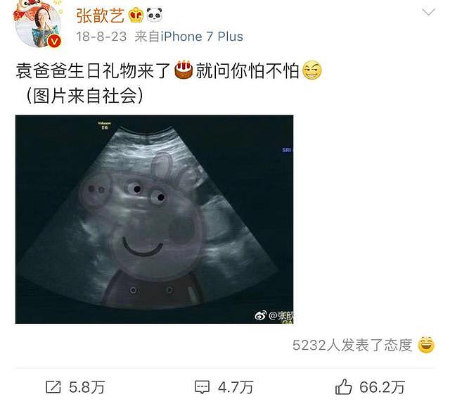 张歆艺晒近照孕肚大到裤拉链都拉不上了，网友：怀孕最久的女明星！