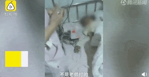 中国8岁女孩被2男童用笤帚戳下体！血流不止 ，或丧失生育能力！家属：老师一旁看着...（视频/组图） - 15