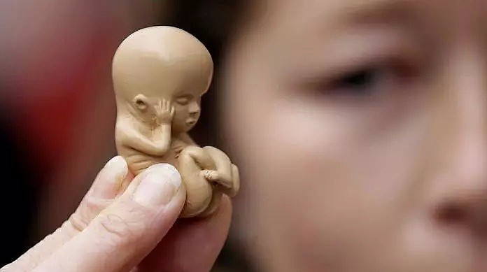95后悉大女生自白：“来澳的第一年，我堕胎了...”全澳每年4000留学生堕胎，众多中国人！ - 8