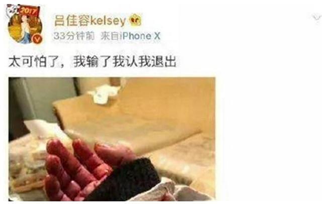 又一女明星深夜割腕自杀，因为忍受不了潜规则？（组图） - 3