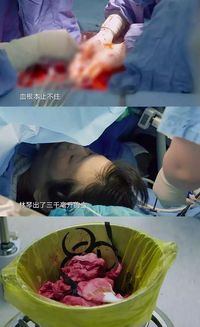 为了生儿子流1万升血全身换血3次，每年还有女星为生儿子死在产房？