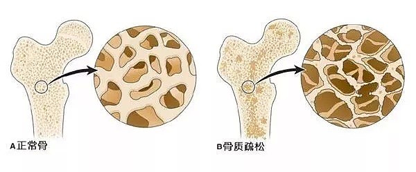 “我拿不出60万给母亲治病”...多少人直到这一刻，才体会到人生的“难”。 - 24