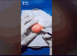 32岁医生竟给水果做手术？一夜吸粉12万！网友：“我的膝盖跪烂了”（视频/组图） - 12