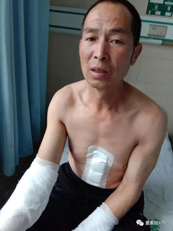 2018年7月，小雨父亲王新元在涞源当地医院接受治疗。