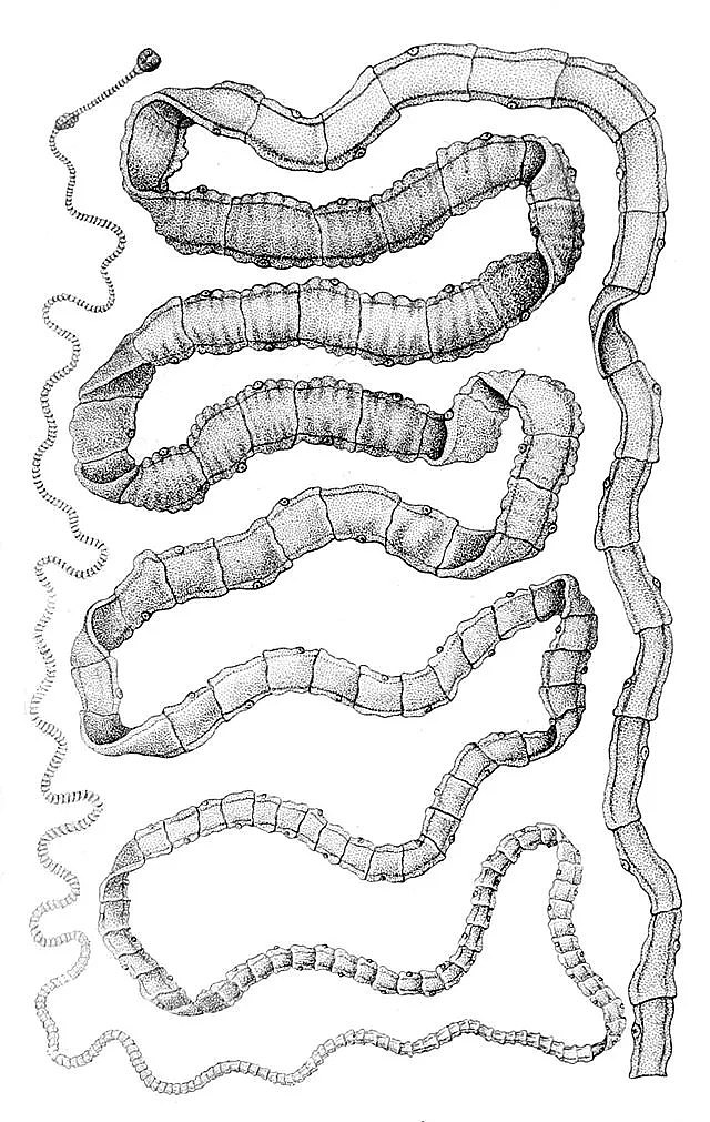 生吞寄生虫：坑骗了一个世纪的荒唐减肥法（组图） - 12