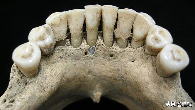 从1000年前的牙垢里，考古学家们竟然发现了贵比黄金的东西