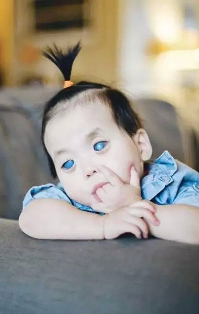 他们收养一个有特殊“蓝眼睛”的中国小女孩，改变了她的一生... - 3