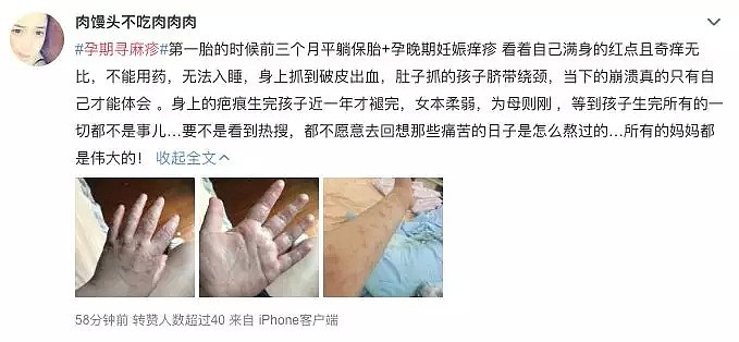 澳洲华人准妈妈孕期可怕经历，引发2.1亿网友热议！怀孕致女性DNA衰老11岁（组图） - 16