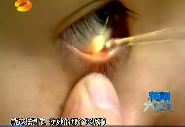 成都硬核“大保健”，洗眼直接用刀片