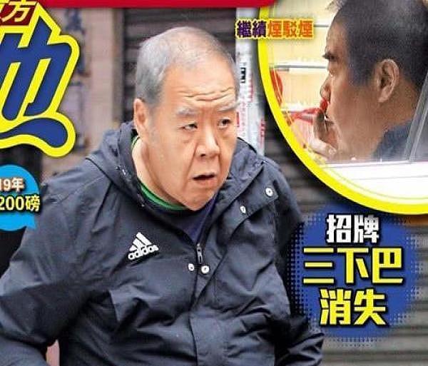 67岁“肥猫”晚景凄凉，竟因患病瘦到脱相？妻子举动惹人泪目！