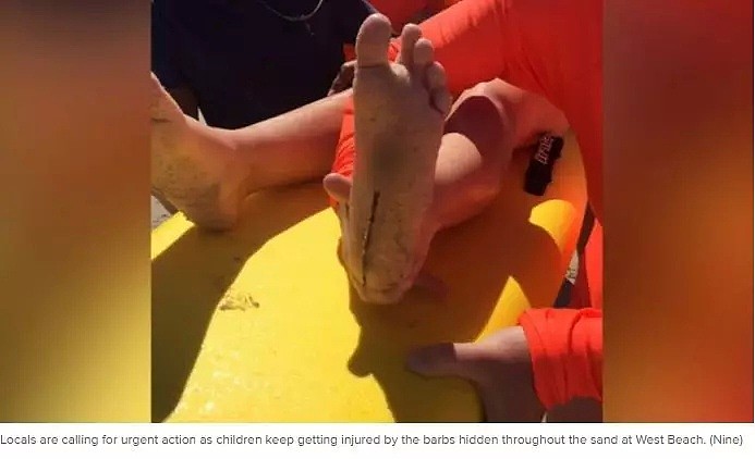 注意！澳热门沙滩惊现多个生锈大铁钩！8岁女童脚心被扎烂！已有4人受伤！ - 10