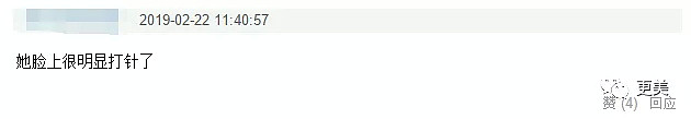 张柏芝脸上这是打了多少吨玻尿酸？比萧蔷还可怕！（组图） - 18
