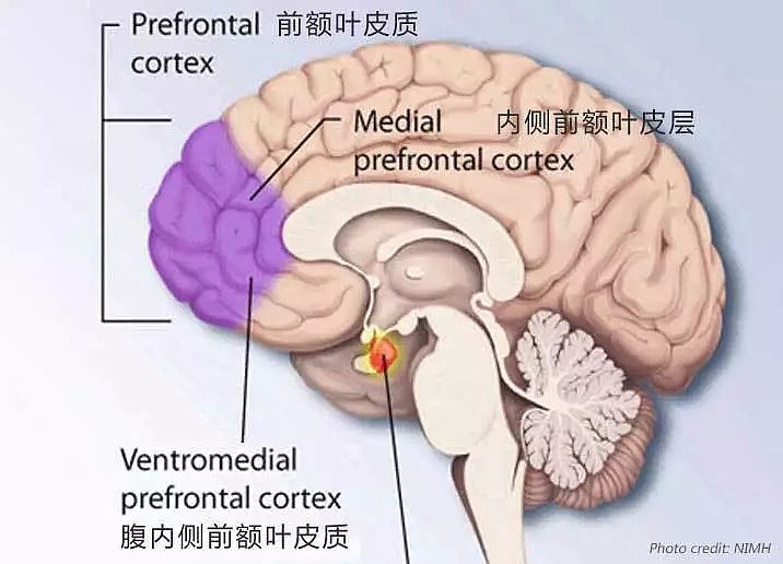 绝望！土澳最新发现：变胖很有可能和大脑的大小有关！所以你不仅胖，还傻？？ - 7