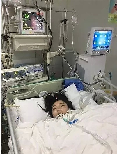 忽视小感冒！澳洲爸爸喉咙痛没看病，竟四肢变黑坏死，差点狗带（组图） - 19