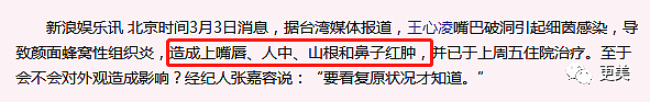 都整的判若两人了，还死犟发声明说纯天然，又不瞎！（组图） - 23