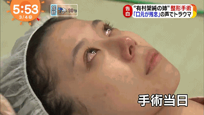 日本女生一直活在明星妹妹的阴影下被嘲讽辱骂每日以泪洗面，怒砸400万整形改变人生！（组图） - 15