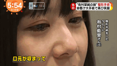 日本女生一直活在明星妹妹的阴影下被嘲讽辱骂每日以泪洗面，怒砸400万整形改变人生！（组图） - 19