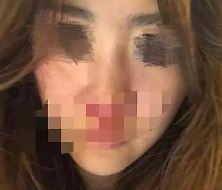 斗鱼渣男主播家暴丑闻被曝光，前女友亲自实锤，伤势触目惊心！