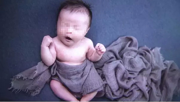 20天婴儿拍完照直接被下病危通知书 妈妈：太后悔（组图） - 3