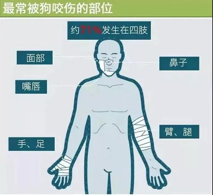 9岁男童遭3只大狗追撵致摔跤，狗主人全程淡定…（视频/组图） - 8