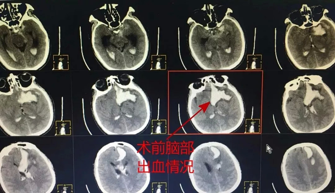 灵堂都搭好了！男子手却突然动了一下！医生说……（组图） - 3