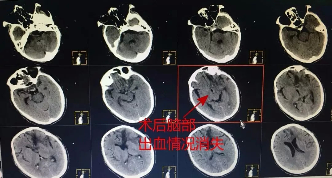 灵堂都搭好了！男子手却突然动了一下！医生说……（组图） - 4